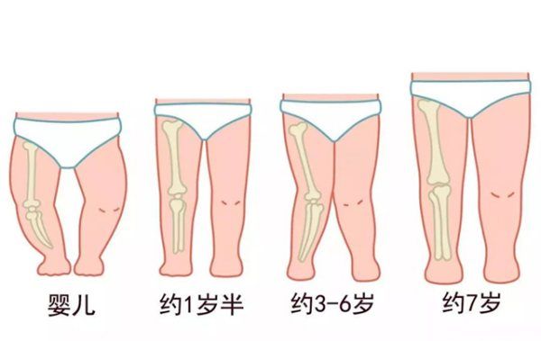 宝宝喜欢跪着坐怎么办，十个月宝宝老是便秘是什么原因图2