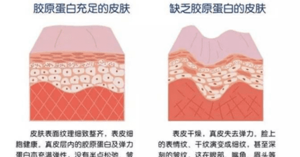 10种食物富含胶原蛋白，含有胶原蛋白的食物有哪些图2