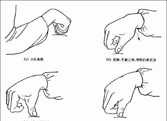 一指禅推法着力点有哪些，一指禅推法的要领有哪些图4