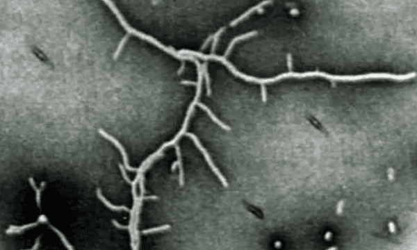 螺旋体属于什么微生物，原核微生物四菌四体是什么意思图4