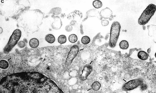 螺旋体属于什么微生物，原核微生物四菌四体是什么意思图5