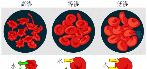 高渗盐溶液有哪些，临床上实用的高渗溶液有啥特点图1